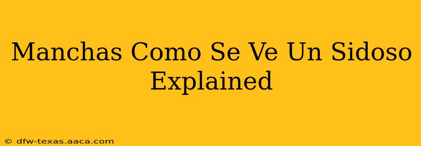 Manchas Como Se Ve Un Sidoso Explained